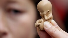 В Ірландії запланували референдум щодо скасування заборони на аборти