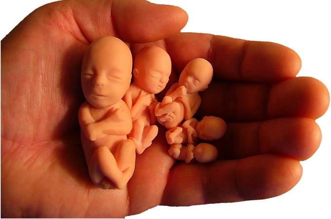 В Ірландії зібрались провести референдум про скасування заборони на аборти