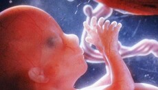 В Миссури законодатели выступили в защиту жизни ещё не рождённых детей