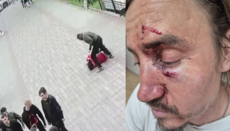Боевики жестоко избили священника УПЦ в Черновцах, его состояние тяжелое