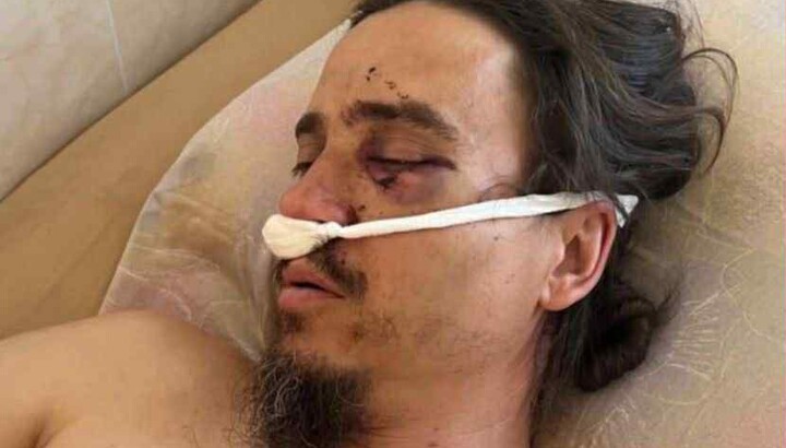 Священник УПЦ отец Роман был избит боевиками возле собора в Черновцах. Фото: Orthobuk