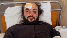 Избитый в Черновцах священник – Варфоломею: Наша кровь – на вашей совести