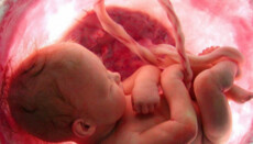 Аборт став основною причиною смерті у світі в 2025 році, – статистика ВООЗ