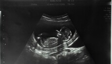 У Британії зафіксували рекордну кількість абортів за всю історію спостережень