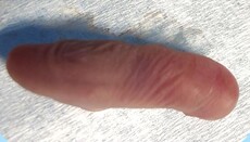 У США вирощують ембріони для пересадки органів без мозку та кінцівок