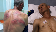 У Сербській Церкві вимагають відреагувати на побиття парафіянина в Косові